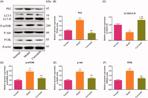 Figure 4. Effect of curcumin on p62, LC3, P-mTOR, p-Akt and P13K proteins in renal tissues of DN-induced rats. (A) The levels of p62, LC3, P-mTOR, p-Akt and P13K proteins from renal tissues were detected by Western blot and normalized to β-actin and then (B–F) relative band intensities were used in order to quantify p62, LC3, p-mTOR, p-Akt and P13K proteins. *p < 0.05, **p < 0.01 vs. the normal group, ##p < 0.01 vs. the model group.