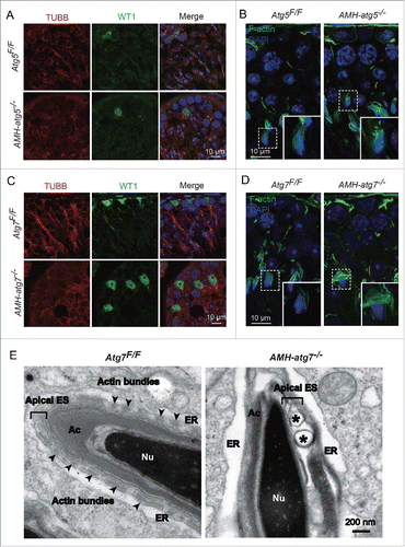Figure 3. The apical ES is disrupted in Sertoli cell-specific autophagy-deficient mice. (A and C) The TUBB structure was disordered in AMH-atg5−/−and AMH-atg7−/− testes. Immunofluorescence analysis using antibodies against TUBB (red) and WT1 (green) was performed in the seminiferous tubules of Atg5Flox/Floxmice (upper panels) and AMH-atg5−/− mice (lower panels) in (A). That of Atg7Flox/Floxmice (upper panels) and AMH-atg7−/− mice (lower panels) are shown in (C). Nuclei were stained with DAPI (blue). (B and D) The F-actin-containing hoops surrounding the elongating spermatid nucleus were perturbed and disorganized in AMH-atg5−/−and AMH-atg7−/− testes. Immunofluorescence analysis using phalloidin (green, labeled by FITC) was performed in the seminiferous tubules of Atg5Flox/Floxmice (left panels) and AMH-atg5−/− mice (right panels) in (B). That of Atg7Flox/Floxmice (left panels) and AMH-atg7−/− mice (right panels) are shown in (D). Nuclei were stained with DAPI (blue). (E) Ultrastructural analysis indicated that the apical ES structure was disrupted in AMH-atg7−/− seminiferous tubules. TEM of Atg7Flox/Floxmice and AMH-atg7−/− mice was performed. In Atg7Flox/Floxmice (left panel), the apical ES was characterized by the presence of actin bundles (arrowheads) sandwiched between the endoplasmic reticulum (ER) and the Sertoli cell plasma membrane. However, in AMH-atg7−/− mice (right panel), the structure of the apical ES was disrupted with large vacuoles (asterisks), and the actin bundles surrounding the elongating sperm head disappeared. Ac, acrosome; Nu, nucleus. See also Figure S5.