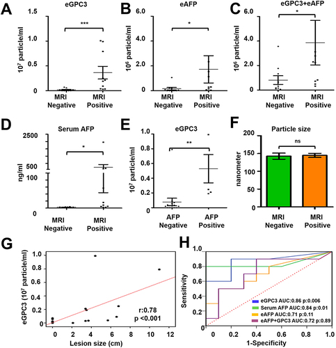 Figure 10 Statistical analysis determines the performance of HCC exosome quantification by fluorescent-nanoparticle tracking analysis (F-NTA) among MRI positive and negative serum samples of our patient cohort. The fluorescence-positive exosome number is normalized with the total number of extracellular vesicles (EVs) captured by light scatter mode in each sample. (A). Quantification of GPC3+ve exosomes in serums obtained from MRI positive and negative cases. (B). Quantification of HCC exosome using PE-labeled AFP antibodies in the same set of serum samples. (C). Quantification of HCC exosomes using a combination of PE-labeled GPC3 and PE-labeled AFP antibodies. (D). Comparison of MRI-positive and MRI-negative cirrhosis samples for serum AFP levels. (E). Comparison for GPC3+ve HCC-exosome concentration in AFP negative and AFP positive groups. The upper limit of AFP was considered as 20 ng/mL (F). Statistical significance levels were presented as ns for non-significant, * for p<0.05, ** for p<0.01, *** for p<0.001. The exosome size is comparable between the MRI-positive and negative groups. (G). Show correlation between HCC-exosome quantification with HCC size determined by MRI in the HCC cohort. (H). ROC analysis shows the sensitivity and specificity values of marker-positive exosome quantification and serum AFP levels for diagnosing HCC in liver cirrhosis.