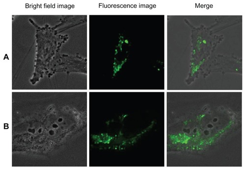 Figure 14 Imaging of (A) human umbilical vein endothelial cells and (B) glioma cells using silica-coated cadmium sulfide quantum dots after 4 hours of incubation.