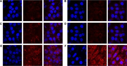 Figure 2 Cellular uptake into MCF-7 cells treated with Nile red solution, Nile red-loaded SLNs, or Nile red-loaded SLNs modified with HPCD for 2 hours or 8 hours of incubation.Notes: (A) Nile red solution for 2 hours, (B) Nile red solution for 8 hours, (C) Nile red-loaded SLNs for 2 hours, (D) Nile red-loaded SLNs for 8 hours, (E) Nile red-loaded SLNs modified with HPCD for 2 hours, (F) Nile red-loaded SLNs modified with HPCD for 8 hours.Abbreviations: SLNs, solid lipid nanoparticles; HPCD, 2-hydroxypropyl-β-cyclodextrin.