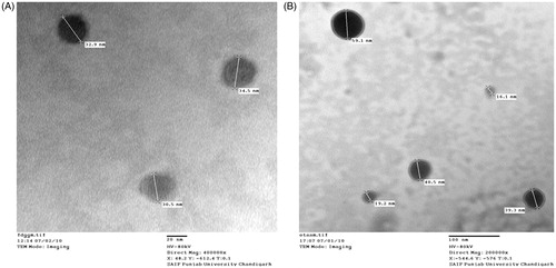 Figure 3. TEM photomicrograph of ACE-loaded: (A) EMVs and (B) ethosomal suspension.
