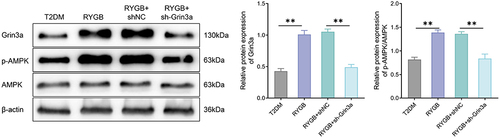 Figure 8 RYGB improves insulin resistance in T2DM rats by regulating Grin3a/AMPK signal axis. Western blot was employed to measure the protein expression changes of Grin3a, AMPK and p-AMPK in rats of each group. **P < 0.01.