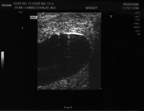 Figure 1. Ultrasound of inflated balloon in mammary gland.