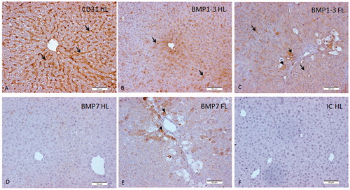 Figure 5. Immunohistochemistry of CD31, BMP1-3, and BMP7 in sections of healthy and fibrotic livers. (A) CD31 was expressed in sinusoidal endothelial cells (SEC), (B) BMP1-3 was expressed in healthy liver mostly in SEC, (C) Expression of BMP1-3 was localized in fibrotic liver hepatocytes and SEC, (D) BMP7 expression was undetectable in healthy rat liver, (E) BMP7 was expressed in fibrotic liver mostly in hepatocytes, and (F) non-immune IgG of the same isotype (IC) in concentration as the primary monoclonal antibody was used as a negative control. HL:healthy liver; FL: fibrotic liver. Arrows indicate SEC and arrowheads indicate hepatocytes (40×). Scale bar length is 50 µm.