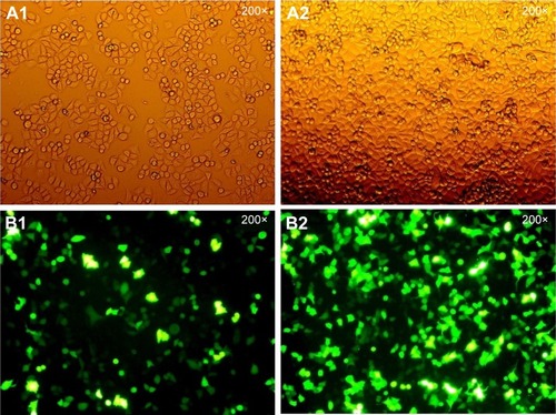 Figure 1 The HepG2 cells were transfected with Egr-1 siRNA.