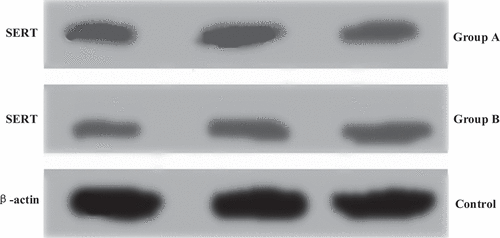 Figure 4. Grayscale analysis results of mouse protein expression level