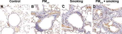 Figure S2 PM2.5 aggravated smoking-induced hyperplasia of alveolar epithelial cells and small-airway epithelia in lungs of mice.Note: (A–D) Representative immunohistochemistry-stained lung sections from control, PM2.5, smoking, and PM2.5 + smoking group, labeled for PCNA (brown, original magnification 200×, bar 50 μm).Abbreviation: PM2.5, particulate matter ≤2.5 μm.