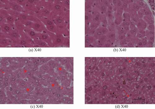 Figure 3. Histological micrographs for Control group (a), EGCG group (b), Ethanol induced group (c) and EGCG + Ethanol group (d). Magnification X40.