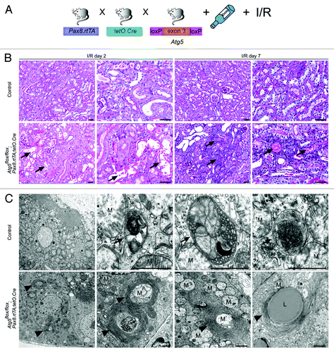 Figure 5. Ischemia/reperfusion results in severe tubular injury in tubule-specific Atg5-deficient kidneys. (A) Two weeks after doxycycline administration Atg5flox/flox;Pax8.rtTA;tetO.Cre mice and control littermates were exposed to ischemia/reperfusion injury. (B) Severe tubular injury in Atg5flox/flox;Pax8.rtTA;tetO.Cre 2 and 7 d after ischemia/reperfusion. Arrows indicate sloughing of tubular cells and tubular lumina filled with detached cells, respectively. (C) Three days after ischemia/reperfusion, ultrastructural analysis revealed increase of autophagosomes and autolysosomes containing mitochondria in control proximal tubular cells. Knockout proximal tubular cells displayed accumulation of damaged mitochondria and concentric membranes surrounding mitochondria, protein aggregates and lipid inclusions. Arrows indicate autophagosomes with their surrounding double membrane and an autolysosome with a single membrane (right), arrowheads indicate concentric membranes, mitochondria are marked with “M” exemplarily, lipid inclusion is marked with “L.” Scale bars: 50 µm in (B), 1 µm in (C).