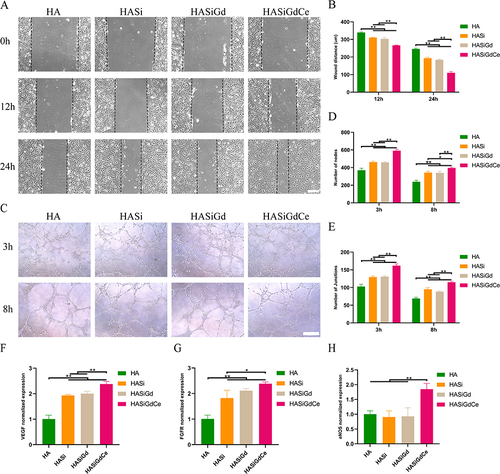 Figure 7 Results of angiogenic Properties studies. (A) Images of migration of HUVECs at 0h, 12 h and 24 h, scale bar: 100 μm. (B) Quantitative analysis of HUVECs migration at 12h and 24h. (C) Images of HUVECs tube formation after incubation for 3 and 8 h, scale bar: 200 μm. (D) Quantitative analysis of tube formation by means of node numbers. (E) Quantitative analysis of tube formation by means of junction numbers. The relative expression levels of VEGF (F), FGFR (G), eNOS (H) in HUVECs assessed by RT-PCR, GAPDH was used as control. *P < 0.05, **P < 0.01.