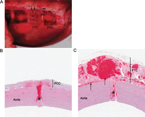Figure 5  Sutureless aortotomy repair. (A) Hemostatic agents 10 min after application in situ during surgery (left is cranial and top is dorsal; cranial pad is FTC and caudal pad is PCC); Hematoma formation over incision (arrows). (B, C) Representative images of hematoxylin and eosin-stained aortic cross sections; x10. (B) Clot formation (asterisk), flush adherence to aortic tissue, and tight sealing with PCC. (C) Clot formation (asterisk), and increased sub- and intrapatch blood accumulation (arrows) with FTC.