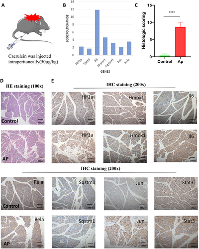 Figure 7 Construction of the mouse AP model and validation of the Hub gene. (A) Construction method of mouse AP model. (B) Validation of the 7 Hub genes in the RNA sequencing data of mouse pancreatic tissue. (C) Histologic scoring of pancreatic tissue. ****P < 0.0001. (D) H&E staining of mouse pancreatic tissue. Scale bar = 200 μm. (E) Validation of 7 Hub genes in pancreatic tissue by immunohistochemistry. Scale bar = 100 μm.