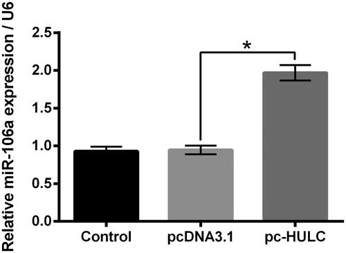 Figure 4. HULC overexpression raised the miR-106a expression in TPC-1 cells. TPC-1 cells underwent pc-HULC transfection, the miR-106a expression was detected. *p < .05.