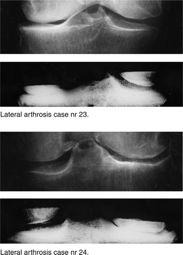 Figure 7. Standing radiographs and corresponding radiographs from experimental setup.