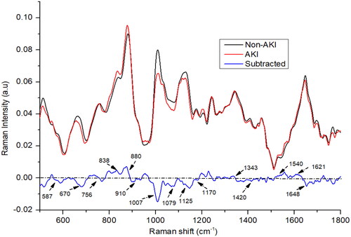 Figure 1. The mean Raman spectra of urine of acute kidney injury (AKI), and non-AKI group.