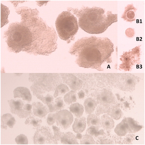 Figure 1. Bovine oocytes. (A) Immature oocytes of acceptable quality for IVP. (B) Immature oocytes of unacceptable quality for IVP (B1: partially nude oocyte; B2: completely nude oocyte with pale cytoplasm; B3: over-expanded oocyte). (C) Oocytes matured in vitro where the majority have good expansion of cumulus cells.