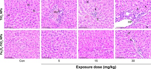 Figure 5 Photomicrography of liver histopathology.Notes: Images (magnification 10×) represent histopathological sections of the liver. Arrows represent small focal-like inflammatory cell infiltration around the hepatic portal (HP) area in the 5 mg/kg TiO2 NP group and around the hepatic vein (HV) in the 15 mg/kg TiO2 NP group, and lymphocyte aggregation in the 30 mg/kg TiO2 NP group. Dark arrows represent liver hepatocyte (H) granule degeneration and small stove liver-cell shrinkage in both Fe3O4-TiO2 NP and TiO2 NP groups at 30 mg/kg.Abbreviations: NPs, nanoparticles; Con, control; S, sinus; K, Kupffer cells.