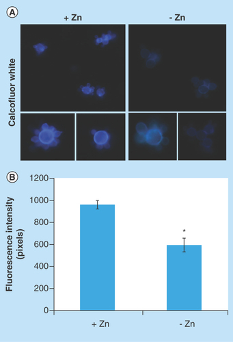 Figure 3.  Effect of zinc deprivation in Paracoccidioides lutzii yeast cells wall.Yeast cells were cultivated in MMcM medium depleted or supplemented with zinc for 24 h. (A) The cells were fixed and stained with CFW (increase of 40 times). (B) Fluorescence intensity (in pixels) of the cells under zinc deprivation. The AxioVision Software (Carl Zeiss) was used to obtain the values of fluorescence intensity. The values of fluorescence intensity and the standard error of each analysis were used to plot the graph. Data are expressed as mean ± standard error (represented using error bars).*p ≤ 0.05.CFW: Calcofluor white; MMcM: McVeigh/Morton’ liquid medium.