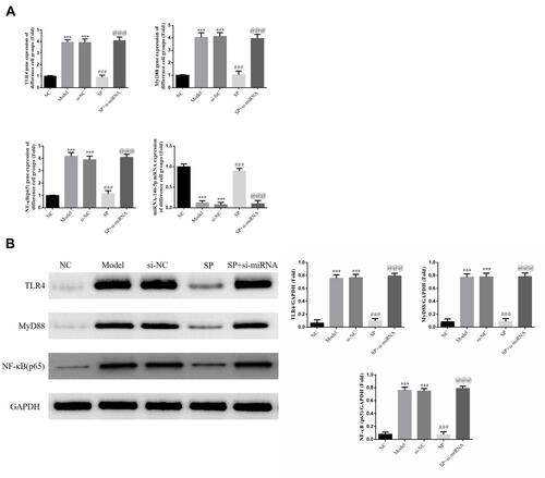 Figure 4 Relative gene and protein expressions in different cell groups. NC: HK-2 cells treated with normal; Model: HK-2 cells treated with high glucose; si-NC: HK-2 cells transfected with si-NC (negative control) and high glucose; standard puerarin (SP): HK-2 cells treated with high glucose and 80 mg/L SP; SP+si-miRNA: HK-2 cells transfected with si-miRNA-145-5p and treated with high glucose and 80 mg/L SP. (A) Relative gene expression measured RT-qPCR assay. ***P < 0.001, compared with NC group; ###P < 0.001, compared with Model group; @@@P < 0.001, compared with SP group. (B) Relative protein expression measured by Western blot. ***P < 0.001, compared with NC group; ###P < 0.001, compared with Model group; @@@P < 0.001, compared with SP group.