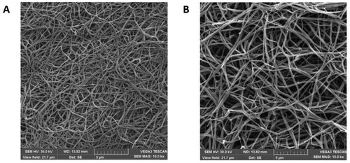 Figure 5. Scanning electron microscopy of fibrin clot. A: Healthy individual; B: Proband.