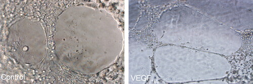 Figure 4. Endothelial-like cells tubular formation assay. No tubular formation was observed when HGFs were cultured in Matrigel for 24 h; while tubular-like structures were observed when endothelial-like cells differentiated from HGFs were cultured in Matrigel for 24 h. Scale bar = 100 µm.