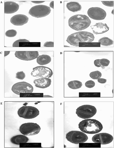 Figure 4. Transmission electron micrograph of BCNS 18 after treated with four MIC of YSMP (b), G. mangostana (c), A. catechu (d), C. longa (e), and alpha-mangostin (f). BCNS 18 (a) was growth in TSB used as a control. MICs of YSMP, G. mangostana, C. longa, A. catechu, and alpha-mangostin against BCNS 18 were 15, 7, 250, 250, and 10 µg/mL, respectively.