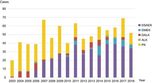 Figure 1 Number of keratoplasty procedures by year. The total annual number of keratoplasty procedures increased from 20 in 2003 to 52 in 2018. PK and DSAEK have consistently remained as major keratoplasty types.Abbreviations: DSAEK, Descemet’s stripping automated endothelial keratoplasty; DMEK, Descemet’s membrane endothelial keratoplasty; DALK, deep anterior lamellar keratoplasty; ALK, anterior lamellar keratoplasty; PK, penetrating keratoplasty.