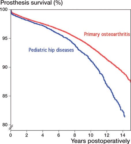 Figure 2. Unadjusted survival curves in the Cox model (Kaplan-Meier curves) with any reason for revision as endpoint in the analysis, for THAs after pediatric hip disease and for THAs due to primary osteoarthritis. The two groups were not comparable, however, due to differences in age, sex, and type of fixation. (The numbers of hips at risk at 14 years were 5,885 for OA and 429 for pediatric hip disease).
