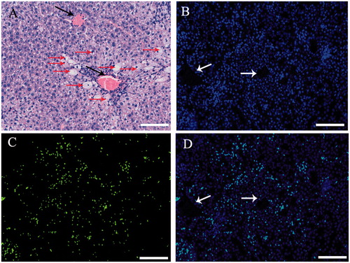 Figure 6. Transplantation of hADSCs, hADSCs-derived hepatocyte resulted in mouse acute liver injury. To test whether transplantation of hepatocyte and hADSCs taken part in recovery of hepatic lobule, paraffin section was used to observed the location for transplantation of hepatocyte in scathing liver tissue. Human nuclei protein was used as a label to discover the hADSCs or hADSCs-derived hepatocyte in tissue of hepatic lobule. The results showed that the human cells were found in mouse liver tissue through IV, but the group of hADSCs was significantly higher than group of hADSCs-derived hepatocyte. (A) Hematoxylin and eosin staining of paraffin section in acute liver injury. (B, C, and D, long arrow: central veins, short arrow: apoptotic hepatocytes) Representative immunofluorescence images of liver 3 weeks post-transplantation, stained for human nuclei protein to confirm the presence of hADSCs. Arrow: central veins. (bar = 100 μm).