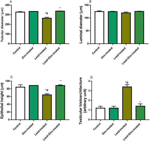 Figure 8. The effects of zinc on testicular seminiferous tubular diameter (A), luminal diameter (B), epithelial height (C) and histoarchitecture using Cosentino’s score (D) in lead-treated male Wistar rats. Values are mean ± SEM of 5 replicates. Data were analyzed by one-way ANOVA followed by Tukey’s post hoc test. *P < 0.05 vs. control, #P < 0.05 vs. zinc-treated, ∼P < 0.05 vs. lead-treated.