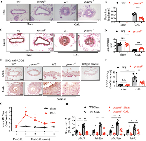 Figure 6. Pycard-/- mice exhibits resistance to vascular injury-induced neointima formation. WT and pycard−/−mice were subjected to sham or carotid artery ligation (CAL) surgery for 28 days. Neointima formation and AGO2 and PRMT8 expression were analyzed. (A) Representative images of H&E staining for carotid artery. Scale bar: 100 µm. (B) quantification of neointima length. (C) Representative images of elastin staining of carotid artery. Scale bar: 100 µm. (D) quantification of relative neointima area (media:lumen ratio). (E) Representative images for AGO2 IHC staining. Scale bar: 100 µm. (F) quantification of IHC staining for AGO2. (G) serum Mir106b level was detected at the indicated time points after CAL surgery. (H) serum levels of Mir17 family members at 1 week after CAL surgery. Data are presented as mean ± SD, n = 4–8 mice/group, * p < 0.05, ** p < 0.01, *** p < 0.001, n.S. p > 0.05 derived from Student’s t tests.