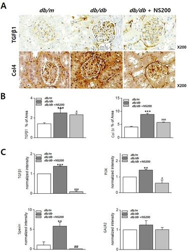 Figure 4. The expression of TGFβ1 and type IV collagen increases in diabetic db/db mice (A, B). However, NS200 inhibits TGFβ1 and type IV collagen expression in diabetic db/db mice (A, B). TGFβ1 and PI3 K mRNA expression increases in diabetic db/db mice and decreases by NS200 (C). Spexin mRNA expression increases in diabetic db/db mice and decreases by NS200, but expression of galanin receptor (GALR) 2 does not differ among the three mouse groups (C). Col 4, type IV collagen. Values are expressed as mean ± SEM. **p < 0.01 db/m mice with vehicle vs db/db mice with vehicle, ***p < 0.001 db/m mice with vehicle vs db/db mice with vehicle, #p < 0.05 db/db mice with vehicle vs db/db mice with NS200, ##p < 0.01 db/db mice with vehicle vs db/db mice with NS200, ###p < 0.001 db/db mice with vehicle vs db/db mice with NS200