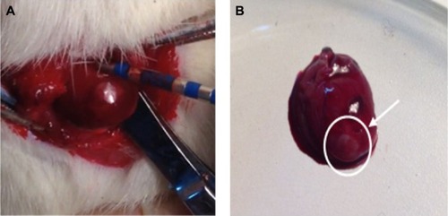 Figure 1 The cardiac radiofrequency ablation of rats in situ and the inflammatory lesions of heart.Notes: (A) Picture showing left ventricle ablation and (B) the heart of the rat after cardiac radiofrequency ablation. The white circle and the arrow denote radiofrequency ablation area.