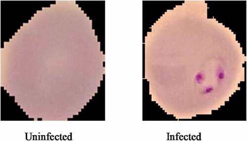 Figure 5. Images of uninfected and infected malaria blood samples.