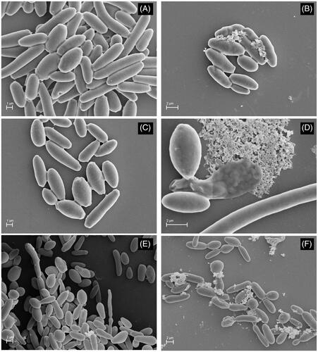 Figure 1. SEM-micrographs of Candida krusei (CK04) treated with fraction WIF from Uncaria tomentosa, alone and in combination with terbinafine (TRB) and fluconazole (FLZ). (A) Control without treatment (10,000×); (B) WIF 7.81 μg ml-1 (10,000×); (C) FLZ resistant strain 64 μg ml-1 (10,000×); (D) WIF-FLZ 3.91: 16 μg ml-1concentration ratio (18,000×); (E) TRB resistant strain 32 μg ml-1 (5000×); (F) WIF-TRB 7.81: 16 μg ml-1 (1000×).