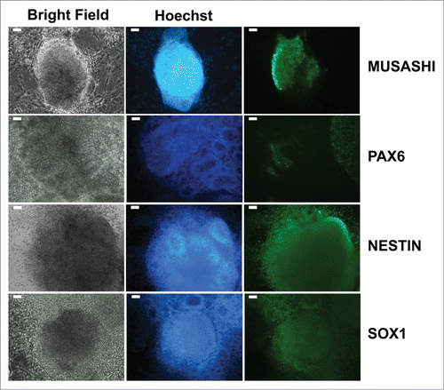 Figure 2. Expression of neural stem cell markers in cellular aggregates developing into neural rosettes observed in differentiating iPSCs cultured in NP expansion medium. Forming neuronal rosettes are more clearly distinguishable in Hoechst staining where nuclei of each neural rosette are arranged radially around a central cavity. Scale bar is 50 μm.