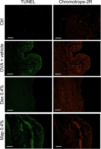 Figure 7 Map and Dex (0.4%; w/v) eye drops do not cause any apparent increase in the number of positive apoptotic eosinophils detected by TUNEL procedure in tarsal conjunctival sections prepared from guinea pigs sacrificed 6 hours after Map and Dex treatment (8 hours after OVA challenge).