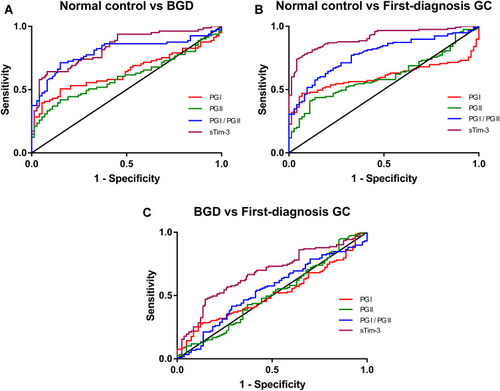 Figure 2 Independent diagnostic value of serum sTim-3, PGI, and PGII levels and the PGI/PGII ratio in BGD and first-diagnosis GC analyzed by ROC. (A) ROC curves of serum marker levels between the controls and BGD patients; (B) ROC curves of serum marker levels between the controls and first-diagnosis GC patients; (C) ROC curves of serum marker levels between BGD and first-diagnosis GC patients.