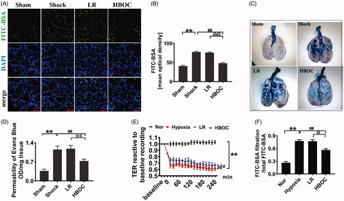 Figure 1. Effects of HBOC on pulmonary vascular permeability after haemorrhagic shock. (A, B) The effects of HBOC on the pulmonary vascular permeability were analysed by measuring the mean OD of FITC-BSA in vivo (bar = 75 μm) (n = 8 observations per group). (C, D) The effects of HBOC on the pulmonary vascular permeability were analysed by measuring the leakage of Evans Blue (n = 8 observations per group). (E, F) The effects of HBOC on the TER and the transmittance of FITC-BSA in monolayer VECs after hypoxia (n = 8 observations per group). Data are presented as mean ± SD, each group contains eight observations, *p < 0.05 and **p < 0.01 as compared with sham operation/normal group, #p < 0.05 and ##p < 0.01 as compared with shock/hypoxia group, @p < 0.05 and @@p < 0.01 as compared with LR group. HBOC: haemoglobin based oxygen carrier; FITC-BSA: fluorescein isothiocyanate-labeled Albumin Bovine V; LR: Lactated Ringer’s solution; Nor: normal group; Sham: sham operation group; TER: transendothelial electrical resistance; VEC: vascular endothelial cell.