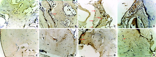 Figure 5. Osteocalcin expression after the two-week (up) and eight-week (down) defect healing period in SR group (A) and (E), SC group (B) and (F), CC group (C) and (G) and AC group (D) and (H) of ovariectomized rats. Arrow – osteocalcin positive “osteocyte-like” cells, 25 μm scale bar.