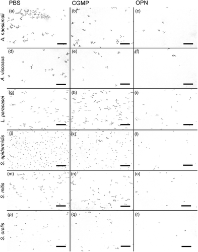 Figure 1. Representative bright field images of adhering bacteria. Adhesion was tested under flow (9.45 µL/h) in the presence of saliva and phosphate-buffered saline (PBS; left column), 460 µM of caseinoglycomacropeptide (CGMP; middle column), or 460 µM of osteopontin (OPN; right column). Considerably fewer cells of Actinomyces naeslundii (a–c), Actinomyces viscosus (d–f), Lactobacillus paracasei subsp. paracasei (g–i), Staphylococcus epidermidis (j–l), Streptococcus mitis (m–o), and Streptococcus oralis (p–r) adhered in the presence of OPN compared to CGMP and control treatment with PBS. In experiments with S. epidermidis, saliva was omitted. Bars = 20 µm.