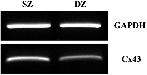Figure 7.  RT-PCR analysis of Cx43 gene expression in immature bovine articular cartilage. cDNA was prepared from cartilage removed from the surface and deep zones of the joint and subjected to PCR using primers specific for housekeeping gene GAPDH (501 bp) and Cx43 (327 bp). The results are representative amplifications from experiments using explants taken from 3 different donors.
