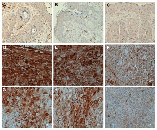 Figure 5 (A–I) The expression of vascular endothelial growth factor from Con-Veh (A), Con -300AE (B), Con -3000AE (C), 14- day human papillomavirus (HPV)-Veh (D), 14-day HPV-300AE (E), 14-day HPV-3000AE (F), 28-day HPV-Veh (G), 28-day HPV-300AE (H), and 28-day HPV-3000AE (I) (magnification × 40).Abbreviations: Con, control; Veh, vehicle; HPV, human papillomavirus; AE, Acanthus ebracteatus Vahl crude extract.