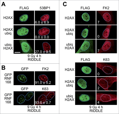 Figure 2. Rescue of 53BP1 IRIF in RIDDLE cells. (A)RIDDLE cells were transduced with lentiviral particles directing the expression of FLAG-tagged H2AX fusion proteins. Four hours after exposure to IR (9 Gy) the cells were processed for immunofluorescence. More than one hundred cells with high level of FLAG signal were scored for 53BP1 IRIF. The percentages of cells with more than 10 53BP1 foci (means ± 1 SD) from 3 to 4 independent experiments are indicated. Scale bar = 10 μm. (B)RIDDLE cells were transduced with lentiviral particles directing the expression of GFP-tagged RNF168. The cells were processed for immunofluorescence 4 h after exposure to IR (9 Gy) using antibodies reacting with GFP, conjugated ubiquitin (FK2) or K63-linked polyubiquitin chains (K63). (C)RIDDLE cells were transduced with lentiviral particles directing the expression of FLAG-tagged H2AX fusion proteins. The cells were processed for immunofluorescence 4 h after exposure to IR (9 Gy) using antibodies reacting with GFP, conjugated ubiquitin (FK2) or K63-linked polyubiquitin chains (K63).