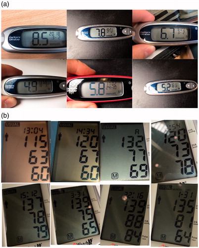Figure 2. Examples of the images taken of the medical devices used in this paper. (a) One Touch Ultra Mini Blood glucose metre. (b) Microlife Watch Home Blood pressure monitor.