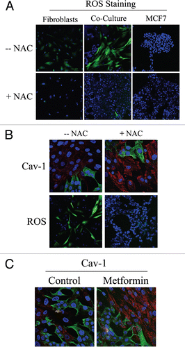 Figure 1 Cancer cells induce ROS production in fibroblasts, driving stromal Cav-1 downregulation: Rescue with anti-oxidants. (A) ROS are elevated in fibroblasts co-cultured with MCF7 cells. To detect ROS generation, CM-H2DCFDA staining (green) was performed on hTERT-fibroblasts co-cultured with MCF7 cells. Also, mono-cultures of hTERT-fibroblasts and MCF7 cells were stained in parallel. Cells were counterstained with Hoechst nuclear stain (blue). Samples were then immediately imaged using a 488 nm excitation wavelength. As a critical control, in a parallel set of experiments, cells were pre-incubated with the ROS scavenger NAC. Note that ROS are generated mainly in co-cultured fibroblasts (upper middle panel) and NAC treatment completely abrogates ROS production. Minimal amounts of ROS were detected in singly cultured cells. Importantly, images were acquired using identical exposure settings. Original magnification, 20x. (B) Treatment with the ROS scavenger NAC restores Cav-1 expression in co-cultured fibroblasts. Day 5 fibroblast-MCF7 co-cultures were incubated with the ROS scavenger NAC (10 mM, right panels) or with vehicle alone (left panels). Upper panels. Co-cultures were fixed and immunostained with anti-Cav-1 (red) and anti-K8/18 (green, detecting tumor epithelial cells) antibodies. DAPI was used to stain nuclei (blue). Note that Cav-1 levels are decreased in fibroblasts in co-culture (left upper panel) and the ROS scavenger NAC blocks the Cav-1 downregulation (right upper panel). Lower panels. In a parallel experiment, CM-H2DCFDA (green) was used to detect ROS generation. Cells were stained with Hoechst nuclear stain (blue). Importantly, images were acquired using identical exposure settings. Original magnification, 40x for upper panels, 20x for lower panels. (C) Treatment with the antioxidant metformin upregulates Cav-1 in co-cultured fibroblasts. Day 5 hTERT-fibroblast-MCF7 cell co-cultures were incubated with metformin or with vehicle alone (control). Co-cultures were fixed and immunostained with anti-Cav-1 (red) and anti-K8/18 (green) antibodies. DAPI was used to stain nuclei (blue). Note that metformin blocks the Cav-1 downregulation that normally occurs in fibroblasts in co-culture. Importantly, images were acquired using identical exposure settings. Original magnification, 40x.