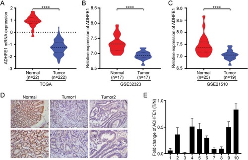 Figure 1 ADHFE1 is down-regulated in CRC. (A, B and C) The expression of ADHFE1 in CRC tissues and normal colorectal tissues in the TCGA mRNAArray data and GEO datasets (GSE32323 and GSE21510). ****p<0.0001. (D) Immunostaining of ADHFE1 protein in 80 CRC tissues and the adjacent normal colorectal tissues. (E) qRT-PCR analysis of ADHFE1 expression in 10 paired CRC tissues; ADHFE1 was quantified relative to the matched adjacent no tumor tissues. Error bars represent means ± SD calculated from three parallel experiments.