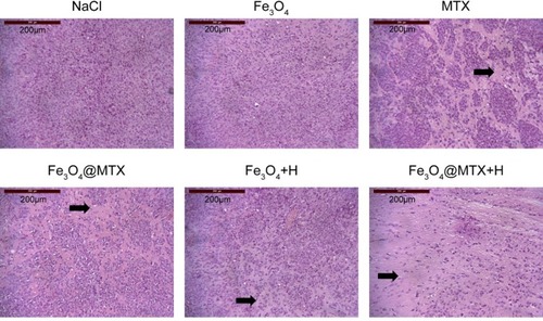 Figure 12 Histopathologic changes in various treatment groups.Notes: Hematoxylin & eosin staining, 10×100 magnification. The arrows illustrate tumor cells disappear at these areas.