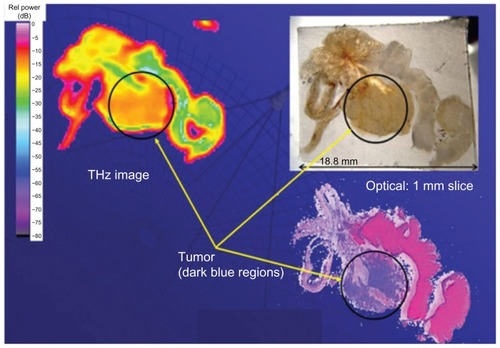 Figure 7 Prostate section with tumor tissue as imaged with terahertz, optical, and staining techniques.